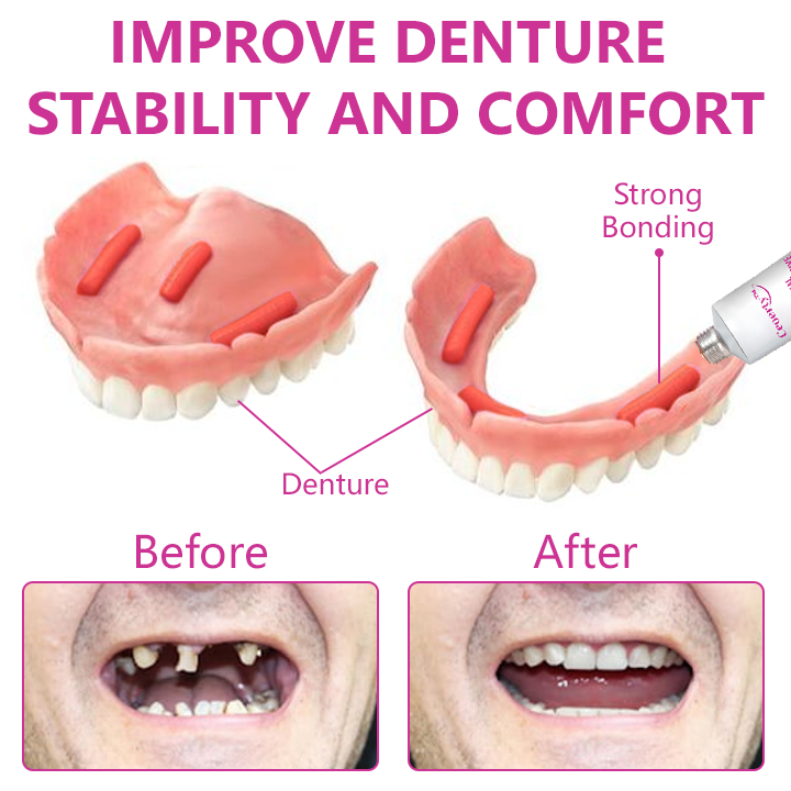 Ceoerty™ Thermal Denture Adhesive