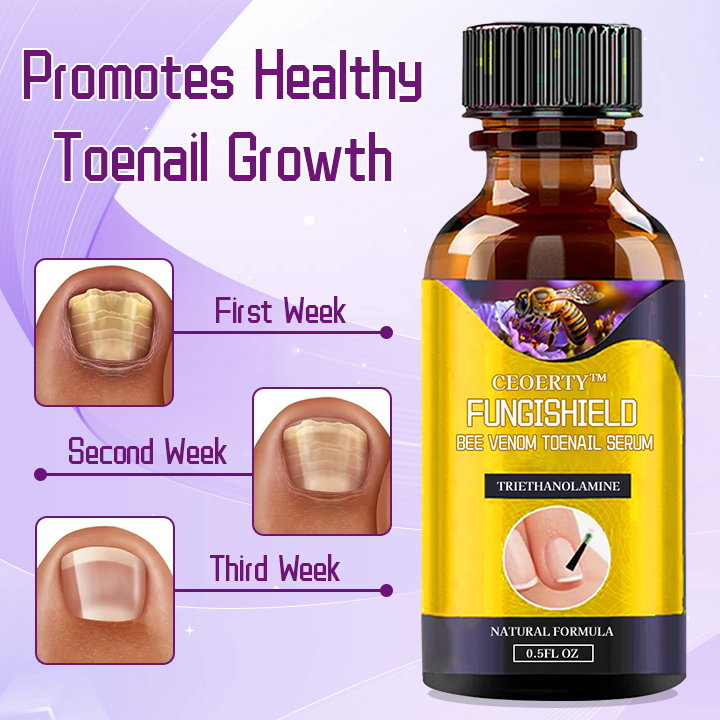 Ceoerty™ FungiShield Bee Venom Toenail Serum