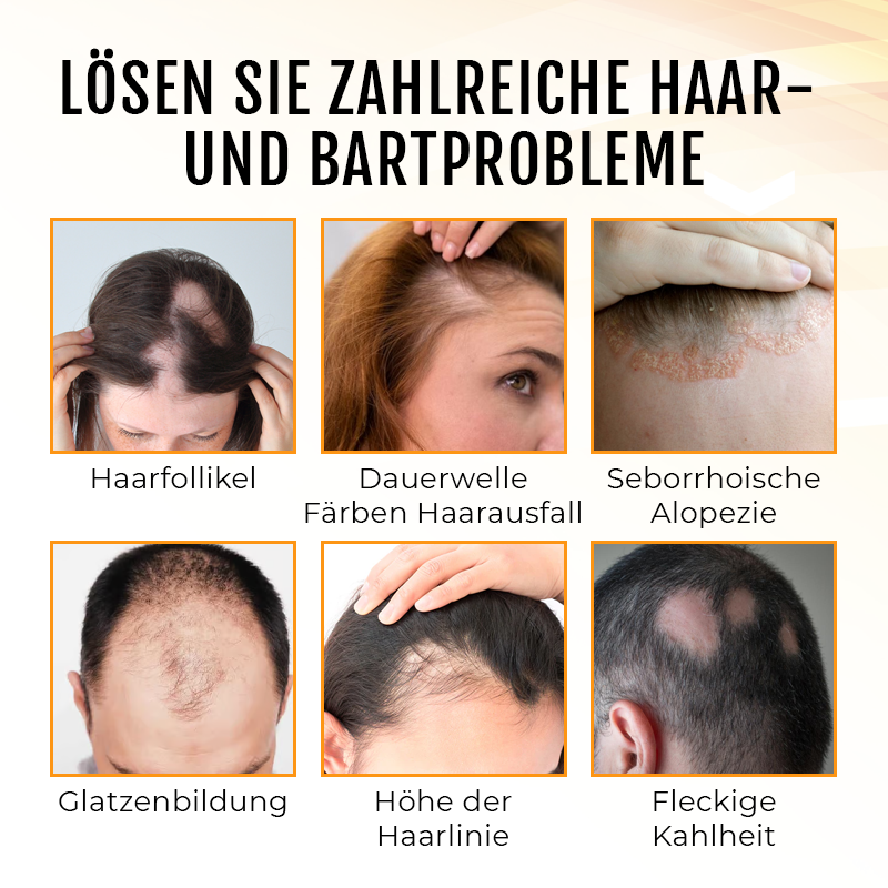 Biancat™ PremiumLocks Biotin Haar- und Bartwachstums-Spray