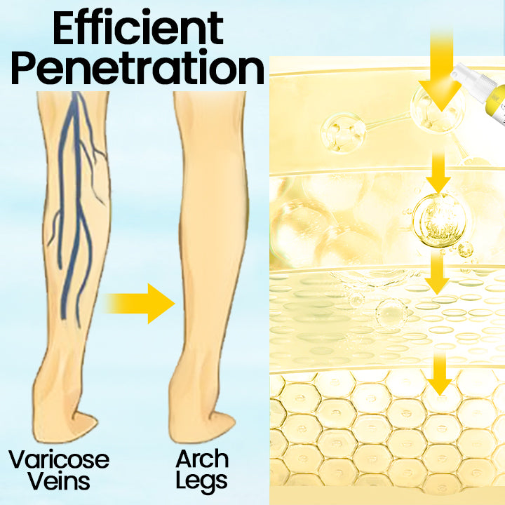 Ceoerty™ VeinMist Varicose Vein Spray