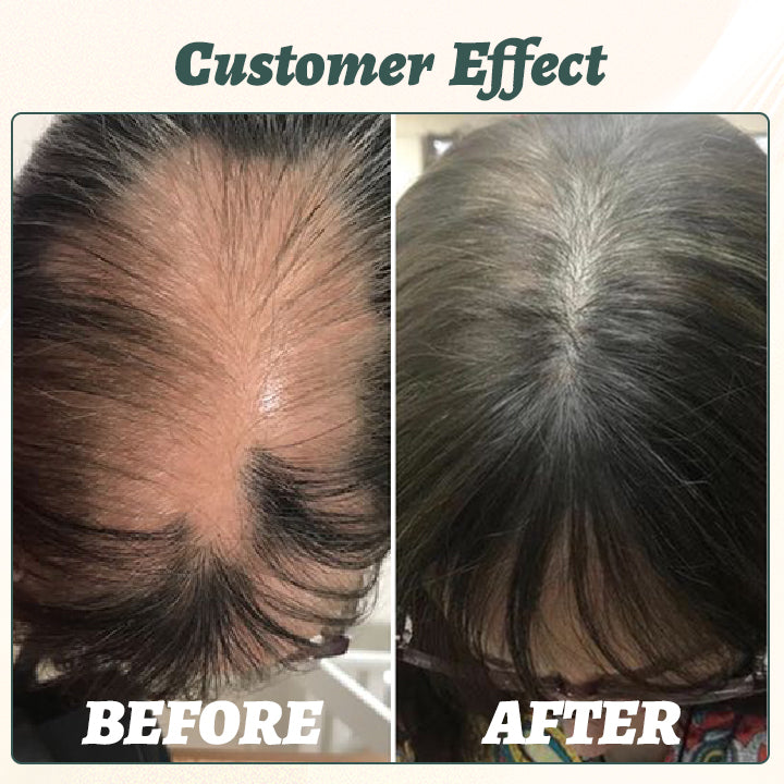 Ceoerty™ GingerEssence Hair Growth Serum