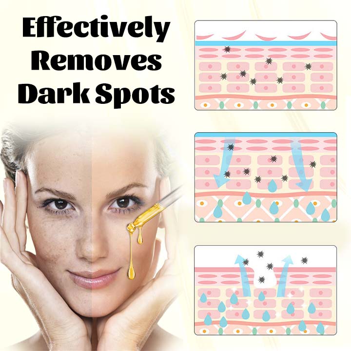 Ceoerty™ RadiantTouch Dark Spot Corrector Serum