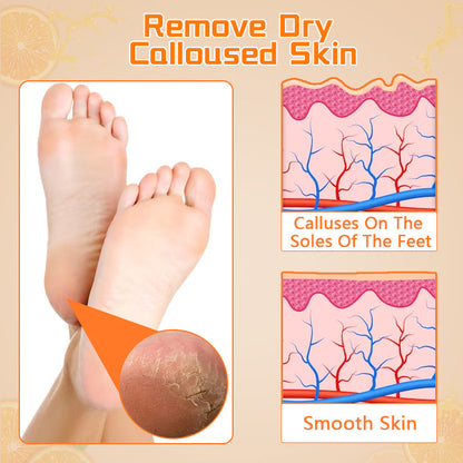 Biancat™ Callus Removing Foot Spray