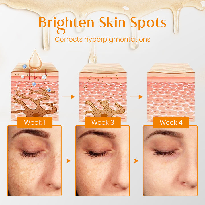 Ceoerty™ SpotErase Turmeric Correcting Serum