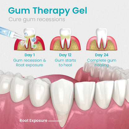 Ceoerty™ Gum Shield Therapy Gel