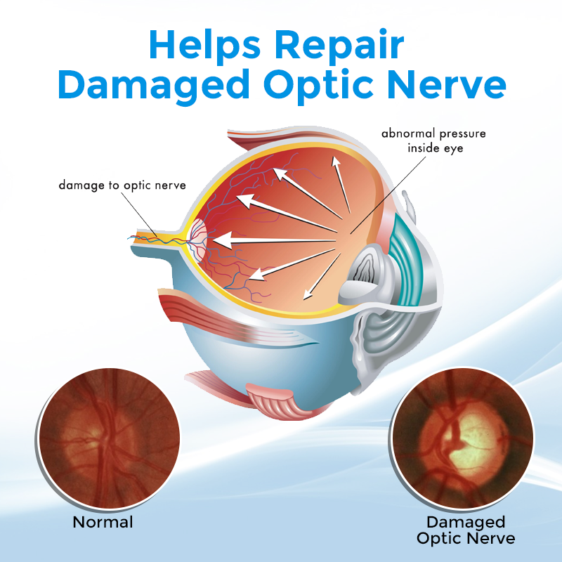 Biancat™ EyeCare Solution Drops