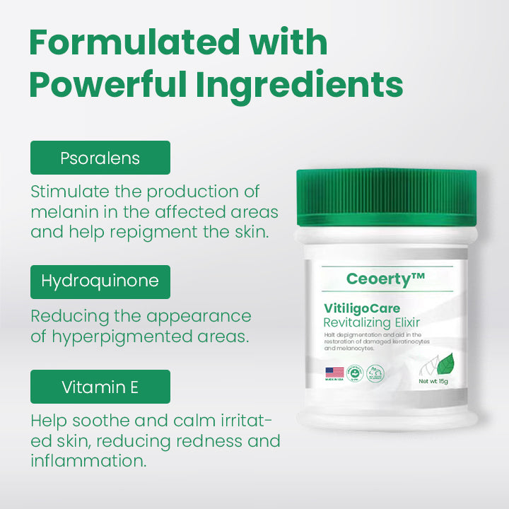 Ceoerty™ VitiligoCare Revitalizing Elixir