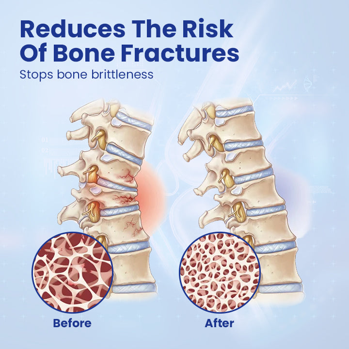 Ceoerty™ JointRenew Bone Repair Gel Roller