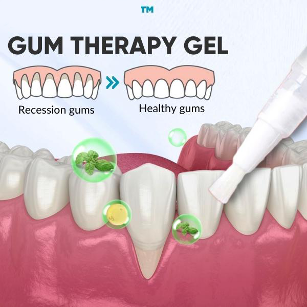 Ceoerty™ Gum Therapy Gel